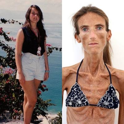 2 Valery Levitin antes e depois