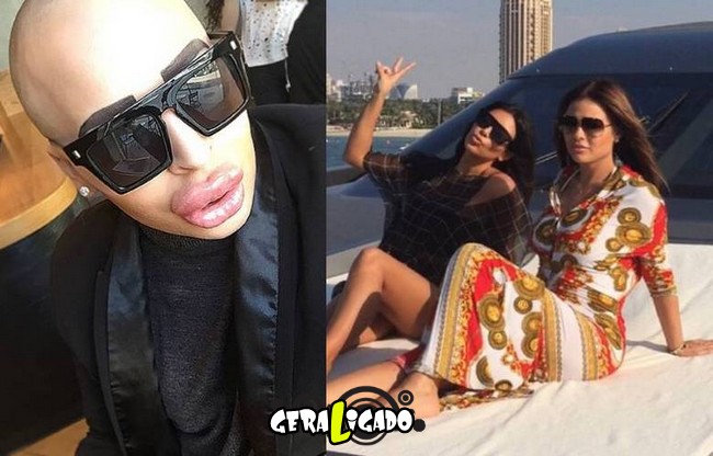 Homem gasta mais de R$ 420 mil para ficar parecido com Kim Kardashian9
