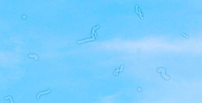 7 -O que são aquelas coisas que se movem quando olhamos para o Sol